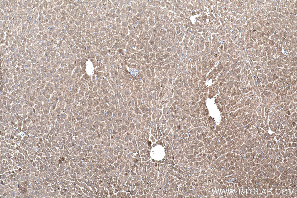 Immunohistochemical analysis of paraffin-embedded mouse liver tissue slide using KHC0571 (AKR1A1 IHC Kit).