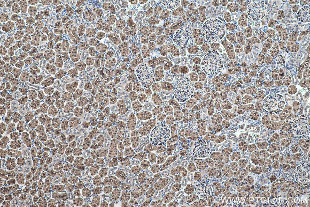 Immunohistochemical analysis of paraffin-embedded rat kidney tissue slide using KHC0571 (AKR1A1 IHC Kit).