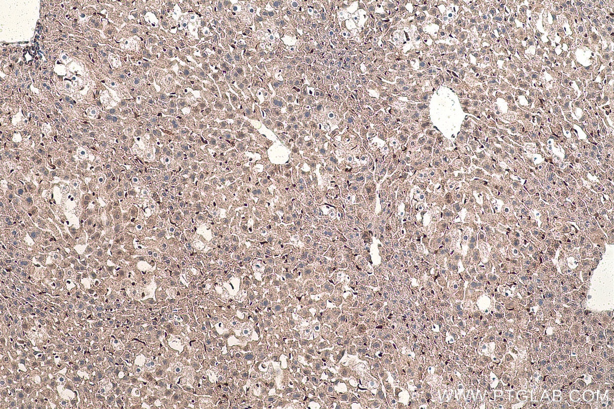 Immunohistochemical analysis of paraffin-embedded mouse liver tissue slide using KHC0863 (AKR1B1 IHC Kit).