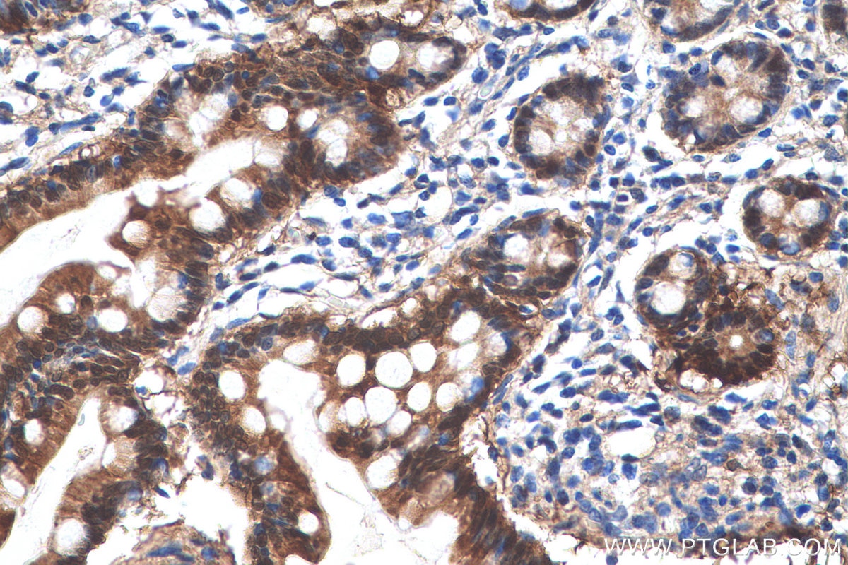 Immunohistochemical analysis of paraffin-embedded human small intestine tissue slide using KHC0665 (AKR1B10 IHC Kit).