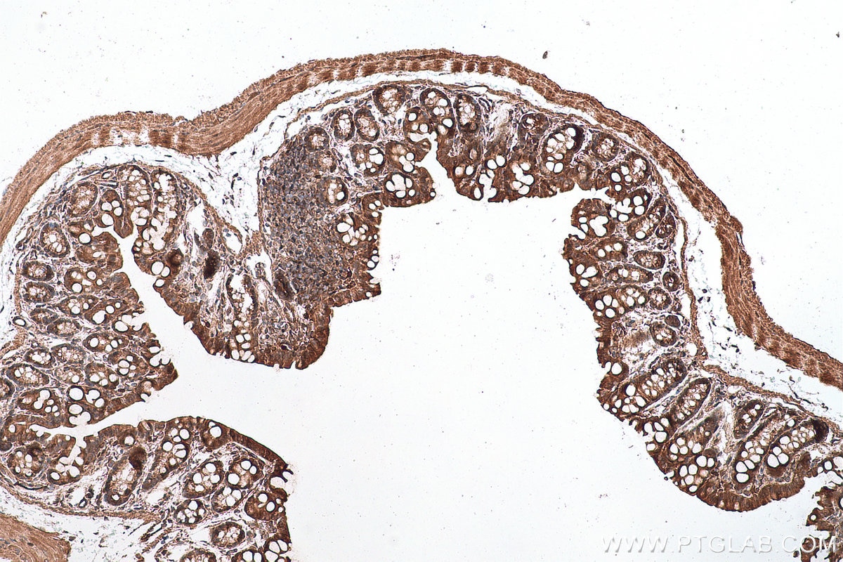 Immunohistochemical analysis of paraffin-embedded mouse colon tissue slide using KHC0665 (AKR1B10 IHC Kit).