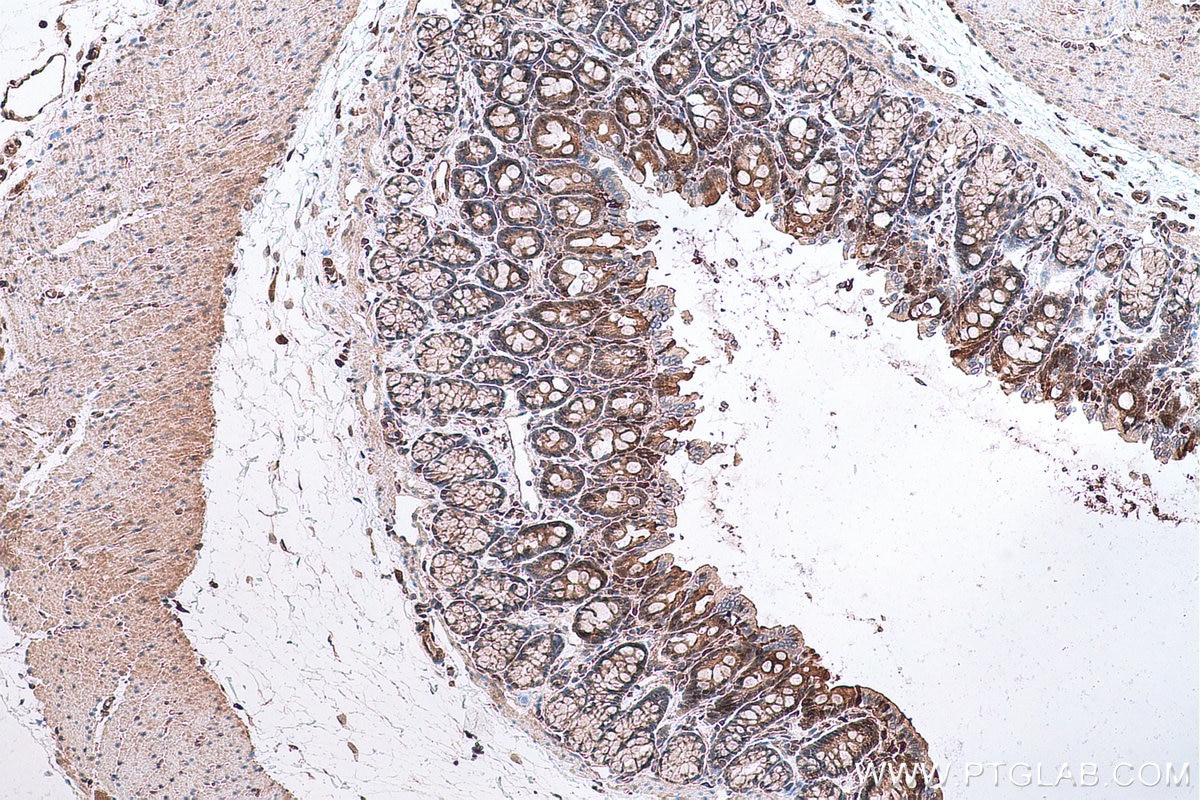 Immunohistochemical analysis of paraffin-embedded rat colon tissue slide using KHC0665 (AKR1B10 IHC Kit).