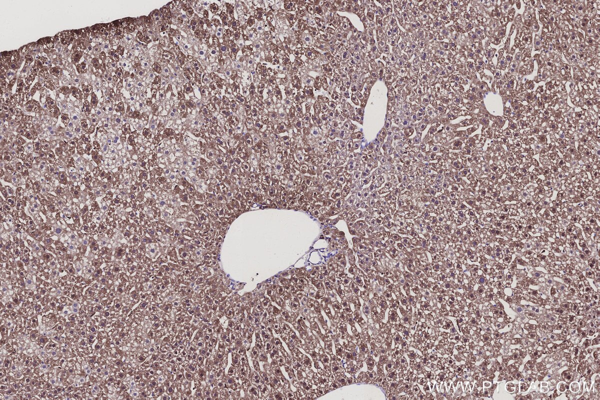 Immunohistochemical analysis of paraffin-embedded mouse liver tissue slide using KHC3143 (AKR7A2 IHC Kit). Immunohistochemical analysis of paraffin-embedded mouse liver tissue slide using KHC3143 (AKR7A2 IHC Kit).