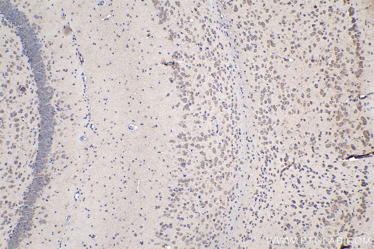 Immunohistochemical analysis of paraffin-embedded rat brain tissue slide using KHC0115 (AKT IHC Kit).