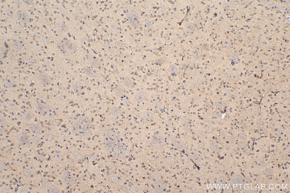Immunohistochemical analysis of paraffin-embedded mouse brain tissue slide using KHC0115 (AKT IHC Kit).