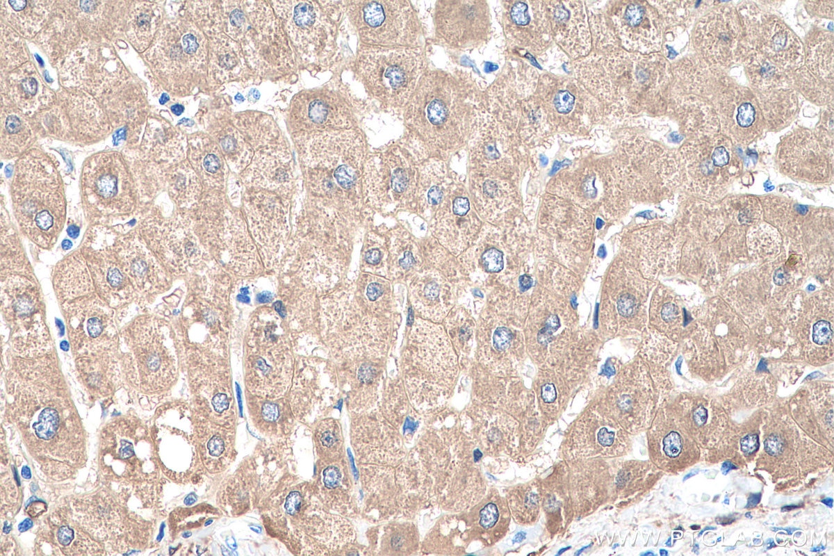 Immunohistochemical analysis of paraffin-embedded human liver tissue slide using KHC0084 (ALDH1A1 IHC Kit).