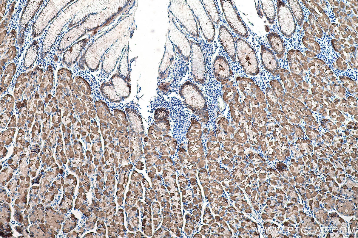 Immunohistochemical analysis of paraffin-embedded human stomach tissue slide using KHC0084 (ALDH1A1 IHC Kit).