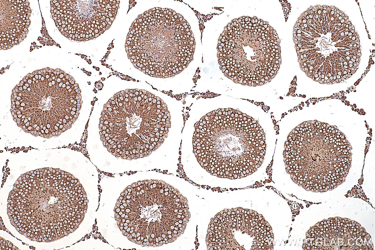 Immunohistochemical analysis of paraffin-embedded rat testis tissue slide using KHC0216 (ALDH1A2 IHC Kit).
