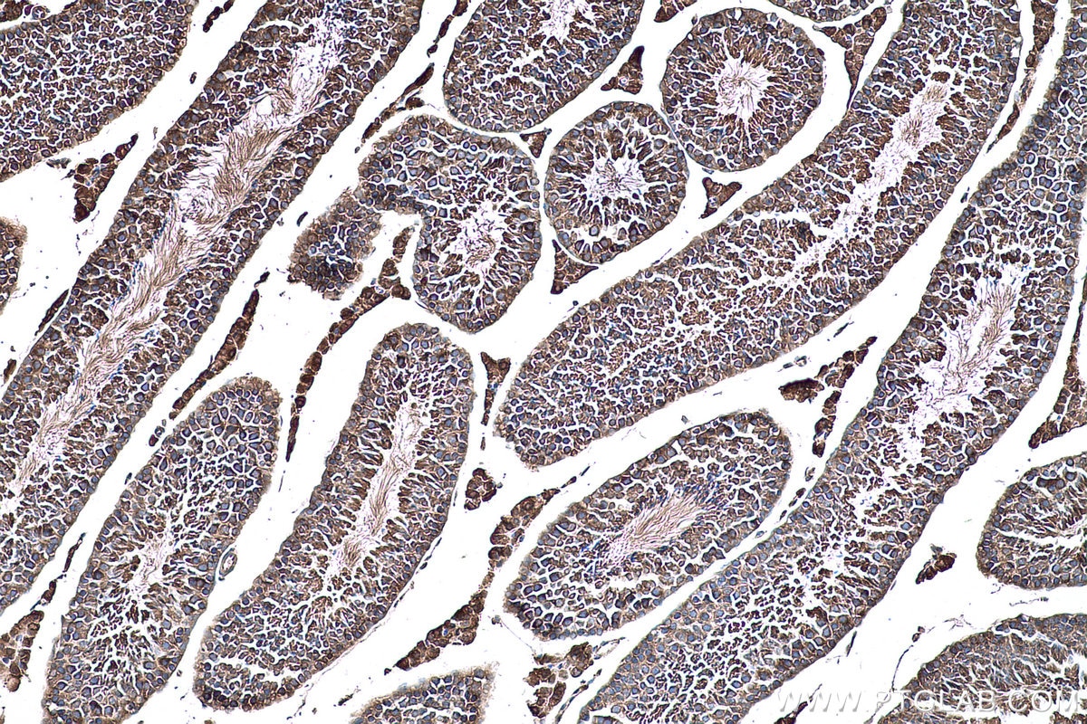 Immunohistochemical analysis of paraffin-embedded mouse testis tissue slide using KHC0216 (ALDH1A2 IHC Kit).