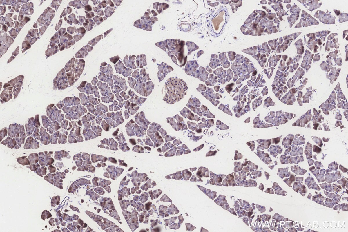 Immunohistochemical analysis of paraffin-embedded mouse pancreas tissue slide using KHC3260 (ALDH1L2 IHC Kit). Immunohistochemical analysis of paraffin-embedded mouse pancreas tissue slide using KHC3260 (ALDH1L2 IHC Kit).