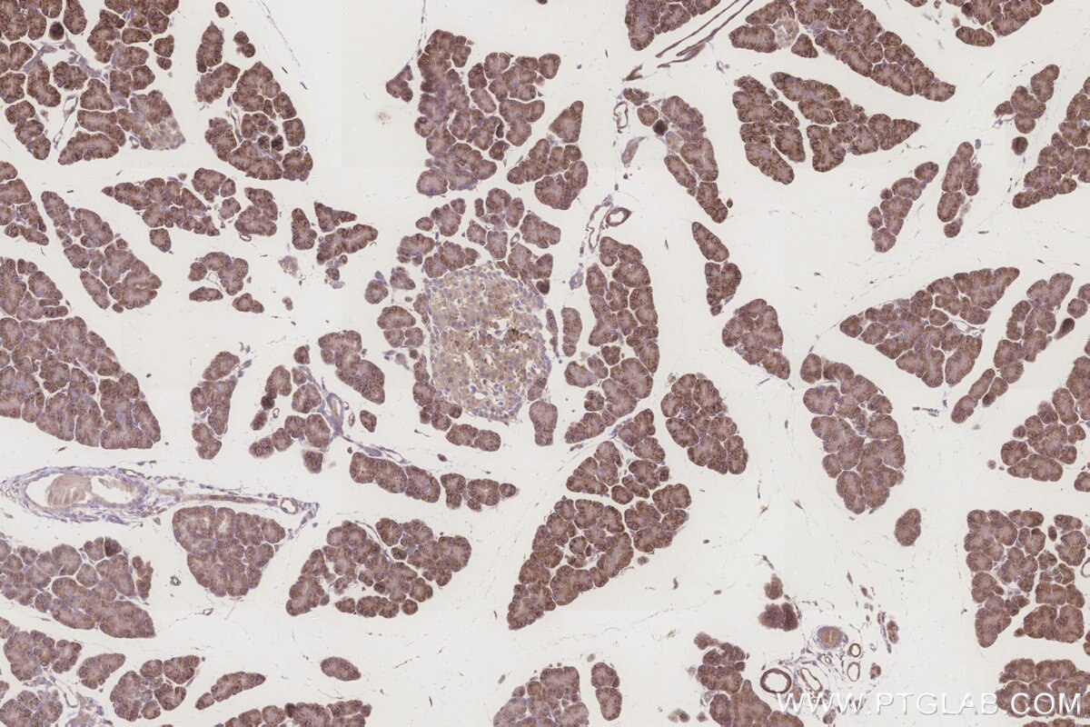 Immunohistochemical analysis of paraffin-embedded rat pancreas tissue slide using KHC3260 (ALDH1L2 IHC Kit). Immunohistochemical analysis of paraffin-embedded rat pancreas tissue slide using KHC3260 (ALDH1L2 IHC Kit).