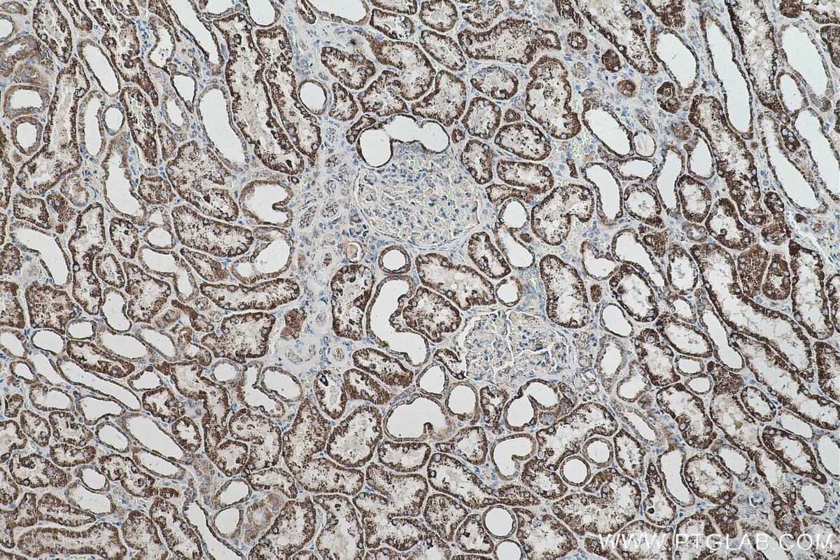 Immunohistochemical analysis of paraffin-embedded human kidney tissue slide using KHC0506 (ALDH2 IHC Kit).