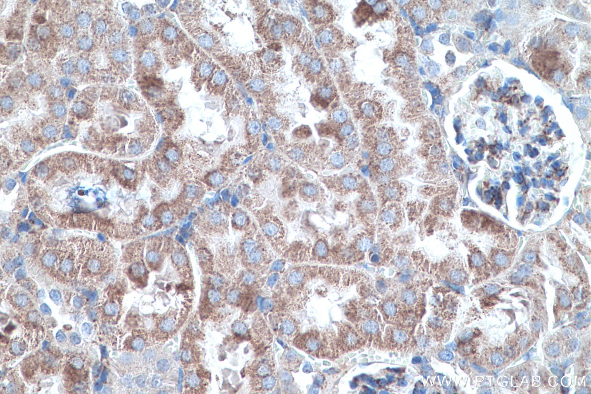 Immunohistochemical analysis of paraffin-embedded mouse kidney tissue slide using KHC0506 (ALDH2 IHC Kit).
