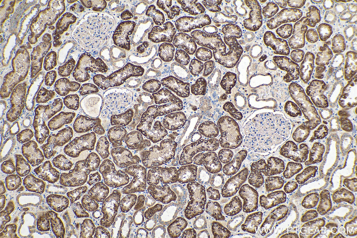 Immunohistochemical analysis of paraffin-embedded human kidney tissue slide using KHC0690 (ALDH3A1 IHC Kit).