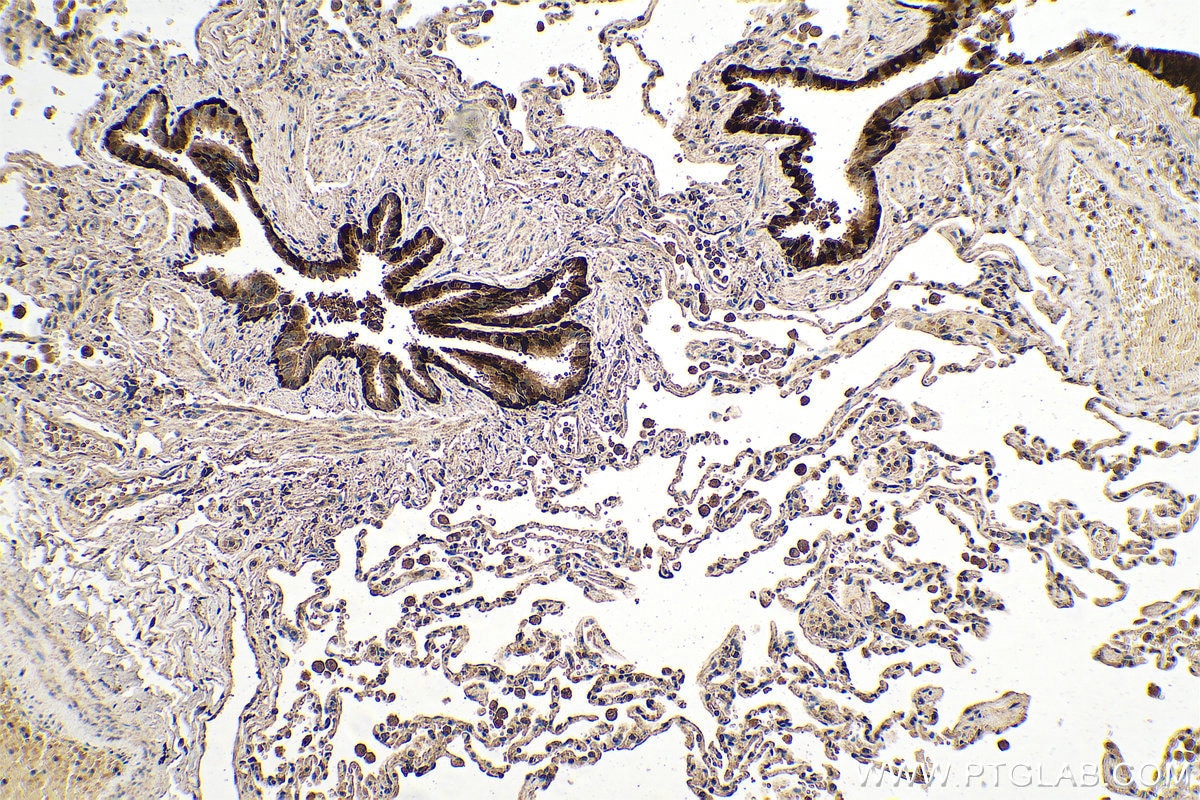 Immunohistochemical analysis of paraffin-embedded human lung tissue slide using KHC0690 (ALDH3A1 IHC Kit).