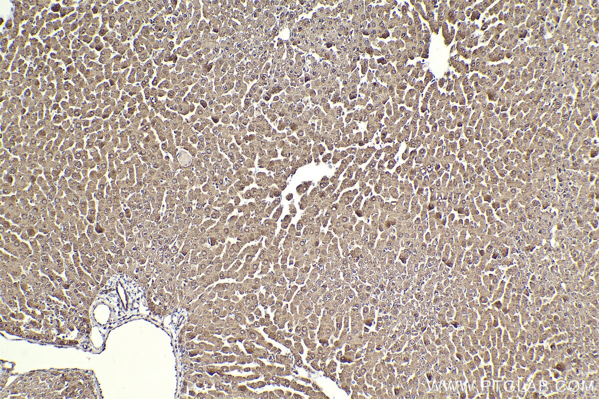 Immunohistochemical analysis of paraffin-embedded rat liver tissue slide using KHC2305 (ALDH3A2 IHC Kit).