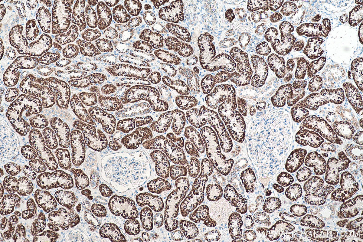 Immunohistochemical analysis of paraffin-embedded human kidney tissue slide using KHC0525 (ALDH4A1 IHC Kit).