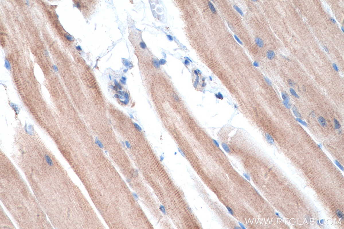 Immunohistochemical analysis of paraffin-embedded mouse skeletal muscle tissue slide using KHC0525 (ALDH4A1 IHC Kit).