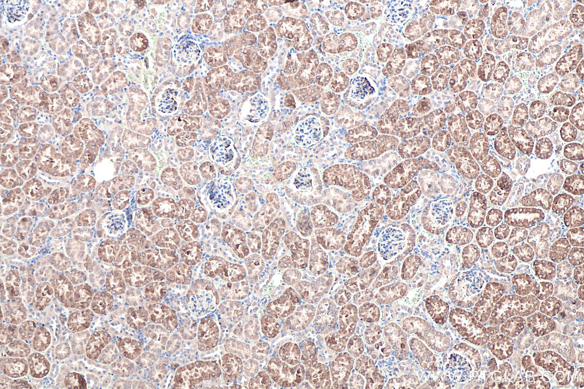 Immunohistochemical analysis of paraffin-embedded mouse kidney tissue slide using KHC0545 (ALDH6A1 IHC Kit).