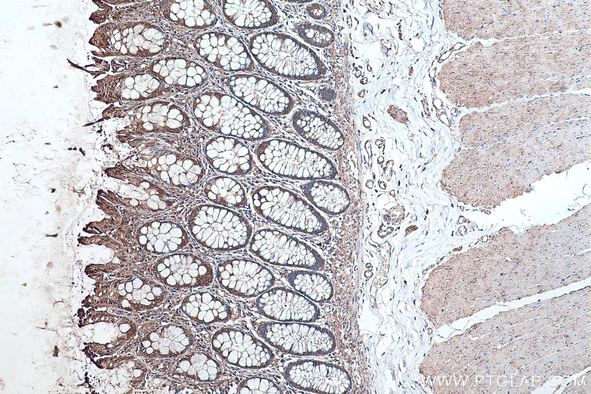 Immunohistochemical analysis of paraffin-embedded human colon tissue slide using KHC0488 (ALDOA IHC Kit).