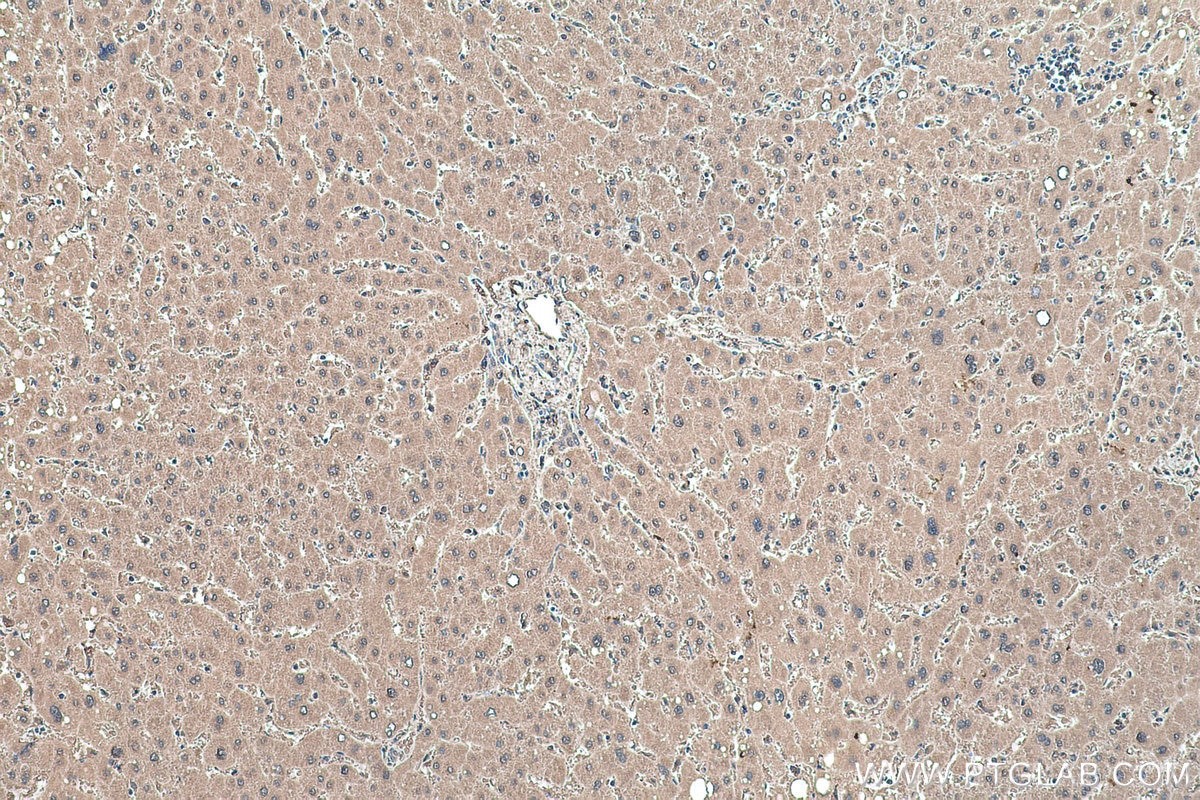 Immunohistochemical analysis of paraffin-embedded human liver tissue slide using KHC0488 (ALDOA IHC Kit).