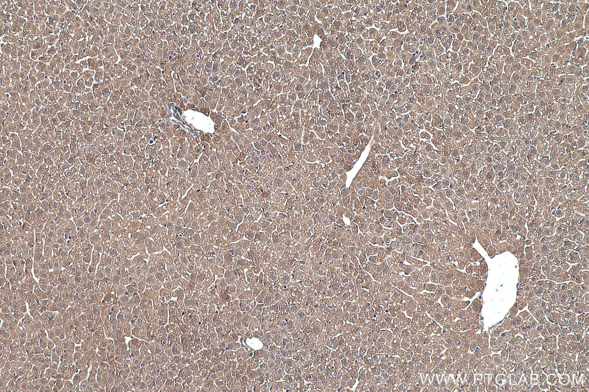 Immunohistochemical analysis of paraffin-embedded mouse liver tissue slide using KHC0488 (ALDOA IHC Kit).