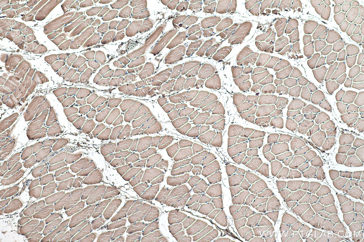 Immunohistochemical analysis of paraffin-embedded mouse skeletal muscle tissue slide using KHC0488 (ALDOA IHC Kit).