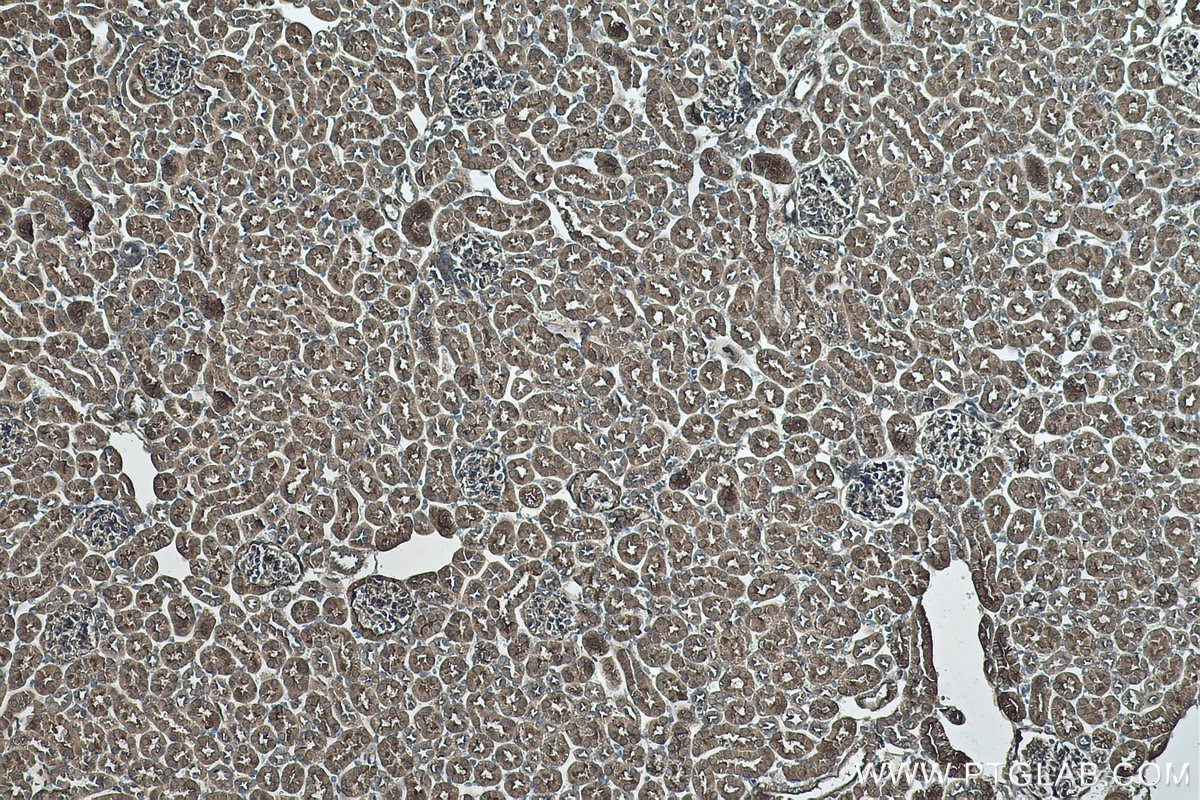 Immunohistochemical analysis of paraffin-embedded mouse kidney tissue slide using KHC0489 (ALDOB IHC Kit).