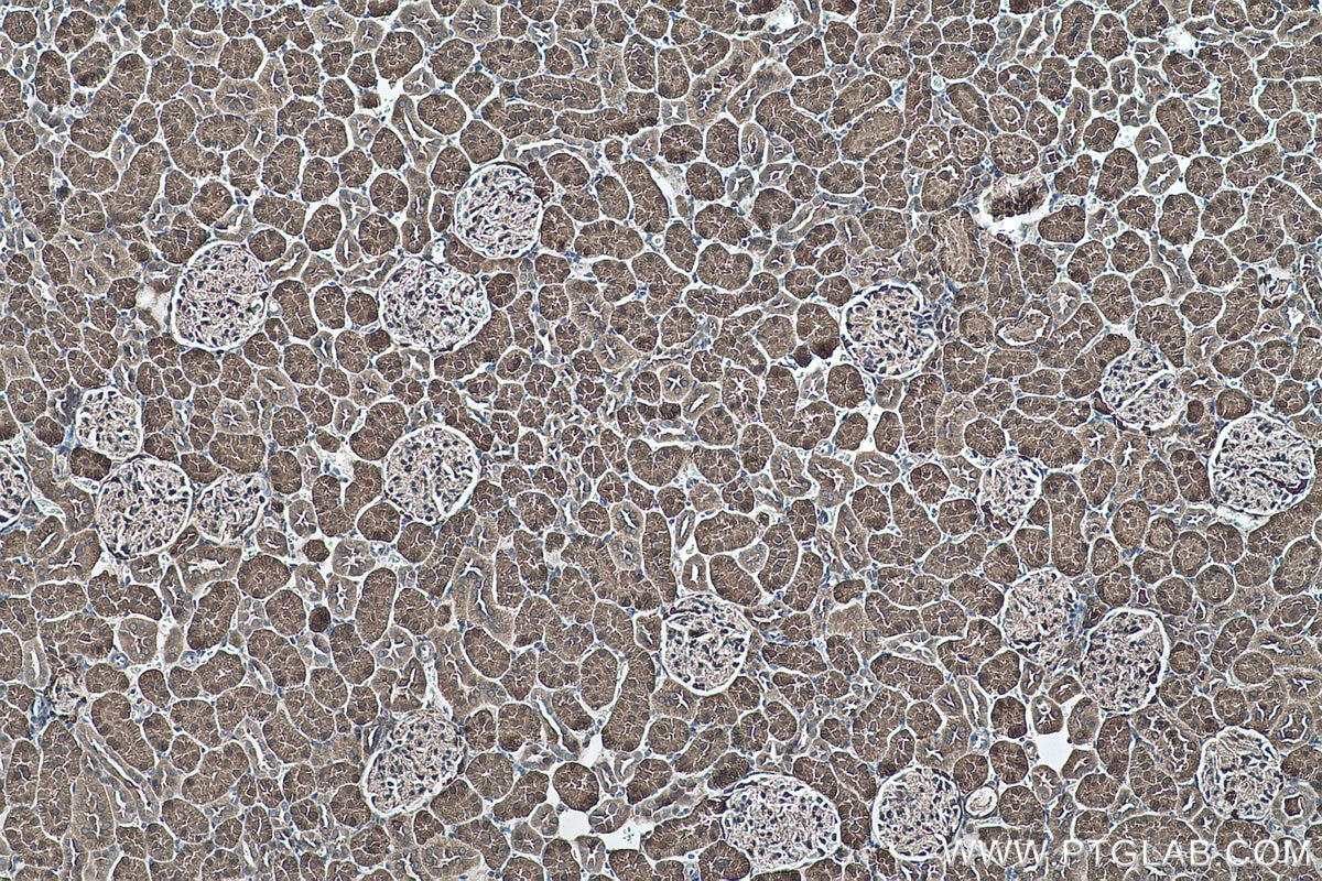 Immunohistochemical analysis of paraffin-embedded rat kidney tissue slide using KHC0489 (ALDOB IHC Kit).