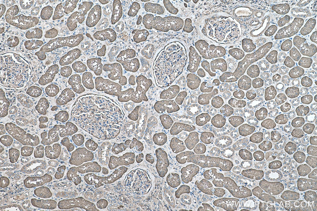 Immunohistochemical analysis of paraffin-embedded human kidney tissue slide using KHC0489 (ALDOB IHC Kit).