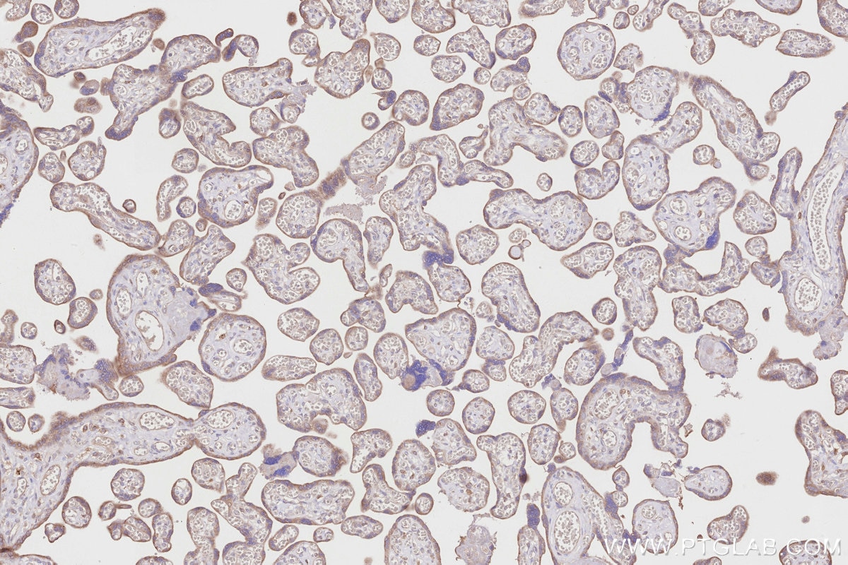 Immunohistochemical analysis of paraffin-embedded human placenta tissue slide using KHC2863 (ALG1 IHC Kit).