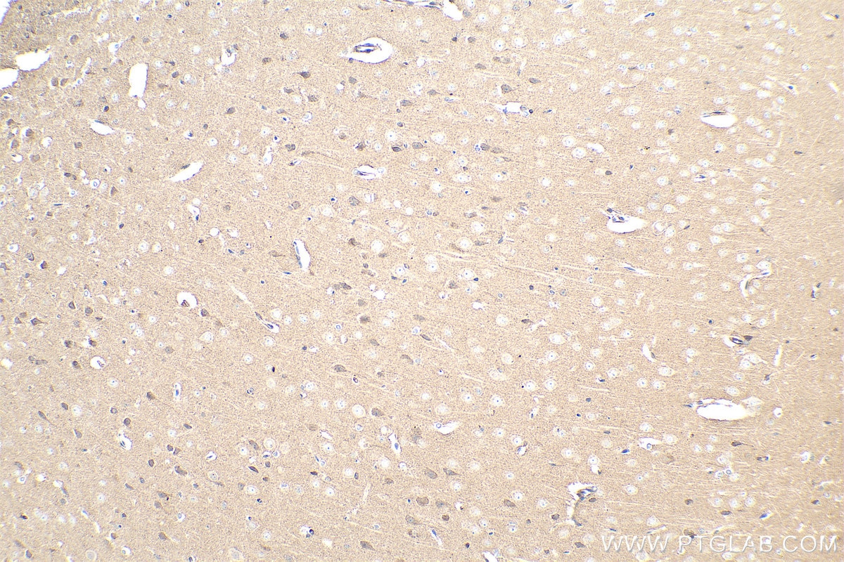 Immunohistochemical analysis of paraffin-embedded rat brain tissue slide using KHC0873 (ALIX IHC Kit).