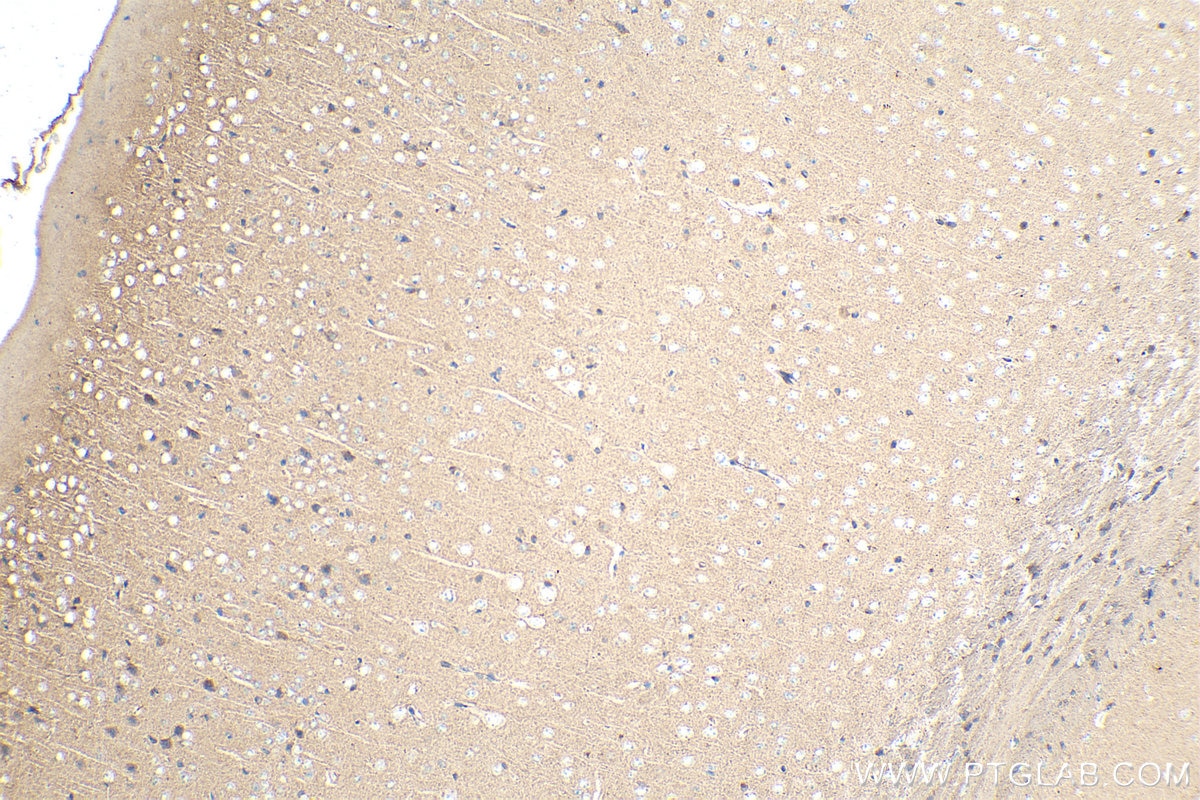 Immunohistochemical analysis of paraffin-embedded mouse brain tissue slide using KHC0873 (ALIX IHC Kit).