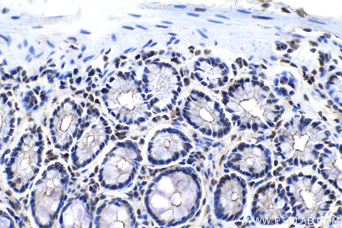 Immunohistochemical analysis of paraffin-embedded rat colon tissue slide using KHC0154 (ALKBH5 IHC Kit).