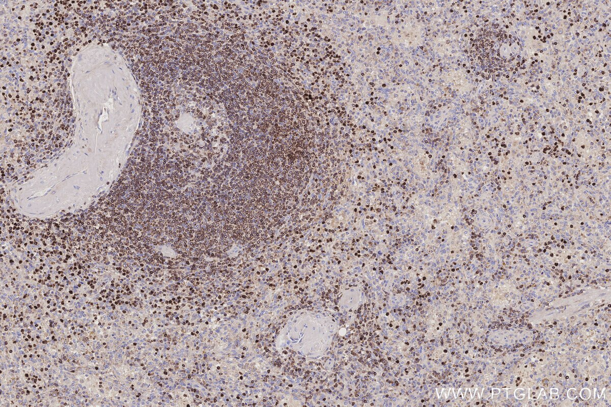 Immunohistochemical analysis of paraffin-embedded human spleen tissue slide using KHC3197 (ALOX5AP IHC Kit).