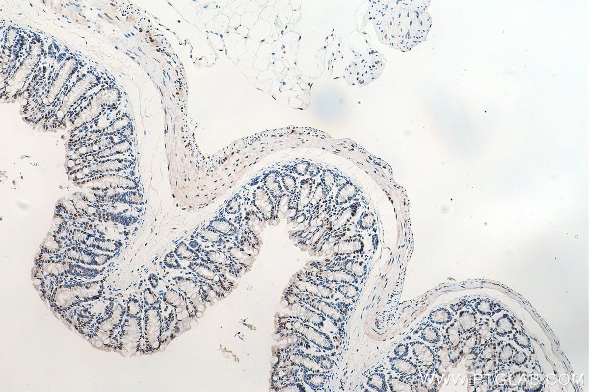 Immunohistochemical analysis of paraffin-embedded mouse colon tissue slide using KHC0175 (ALY IHC Kit).