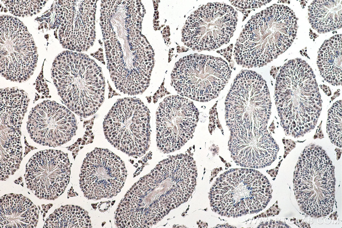 Immunohistochemical analysis of paraffin-embedded mouse testis tissue slide using KHC0175 (ALY IHC Kit).