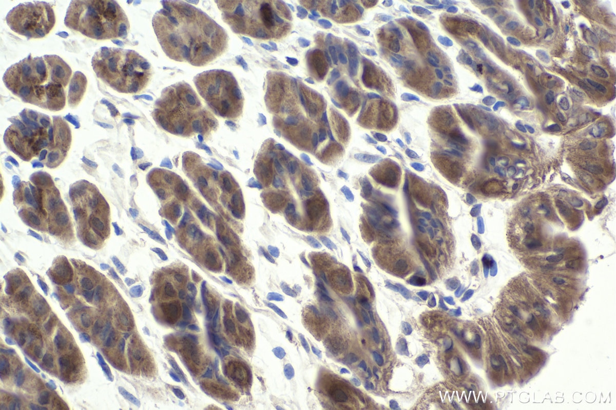 Immunohistochemical analysis of paraffin-embedded mouse stomach tissue slide using KHC1915 (AMBRA1 IHC Kit).