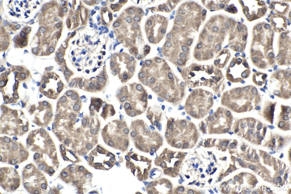 Immunohistochemical analysis of paraffin-embedded mouse kidney tissue slide using KHC1915 (AMBRA1 IHC Kit).