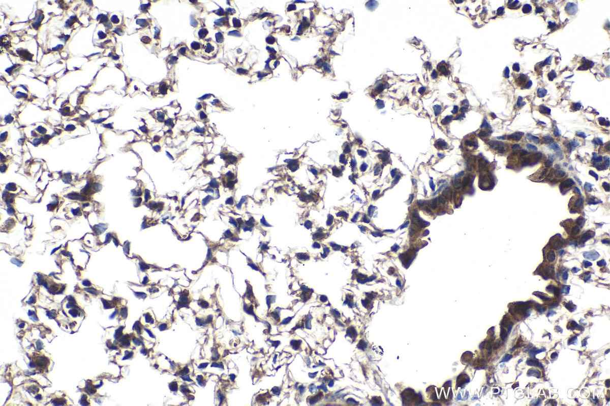 Immunohistochemical analysis of paraffin-embedded mouse lung tissue slide using KHC1915 (AMBRA1 IHC Kit).