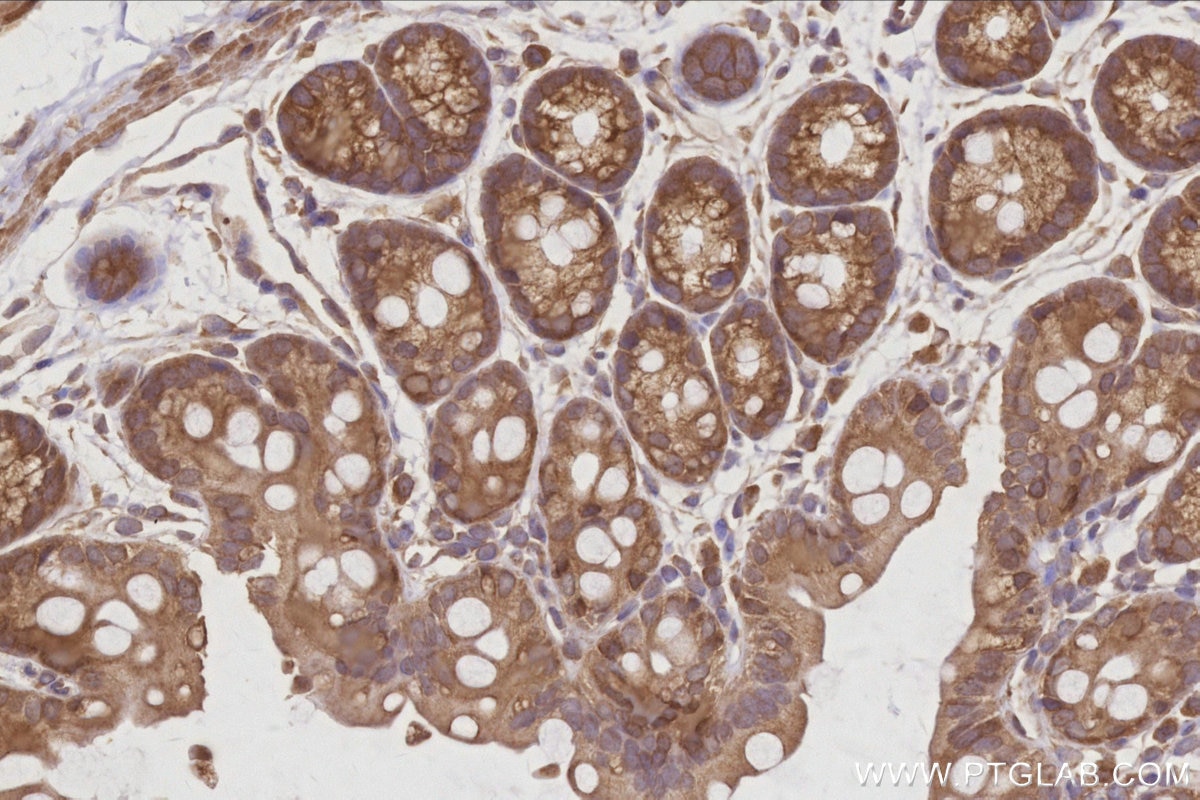 Immunohistochemical analysis of paraffin-embedded mouse colon tissue slide using KHC3030 (AMFR/GP78 IHC Kit). Immunohistochemical analysis of paraffin-embedded mouse colon tissue slide using KHC3030 (AMFR/GP78 IHC Kit).