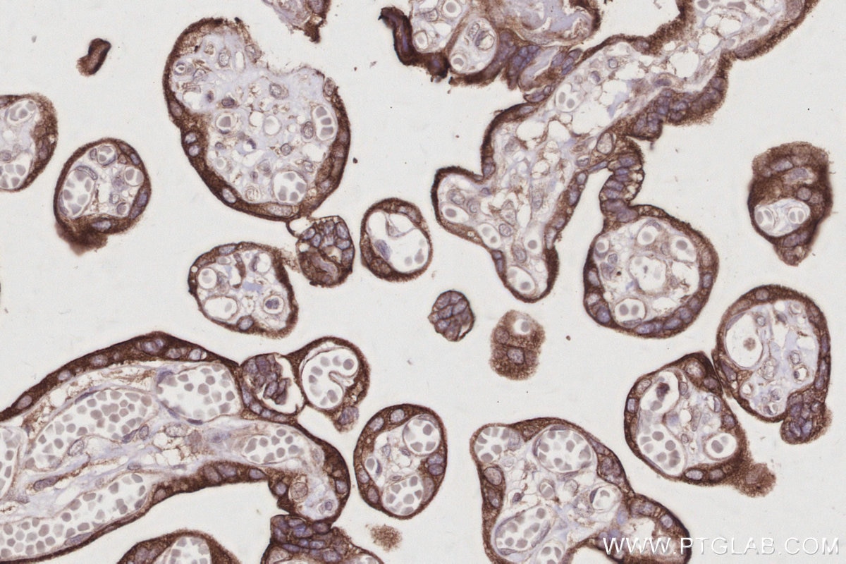 Immunohistochemical analysis of paraffin-embedded human placenta tissue slide using KHC3030 (AMFR/GP78 IHC Kit). Immunohistochemical analysis of paraffin-embedded human placenta tissue slide using KHC3030 (AMFR/GP78 IHC Kit).