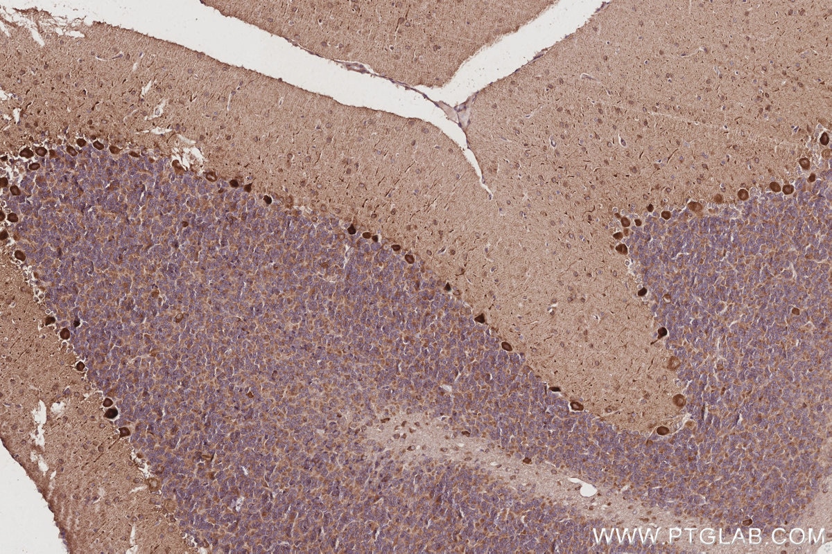 Immunohistochemical analysis of paraffin-embedded rat cerebellum tissue slide using KHC3030 (AMFR/GP78 IHC Kit). Immunohistochemical analysis of paraffin-embedded rat cerebellum tissue slide using KHC3030 (AMFR/GP78 IHC Kit).