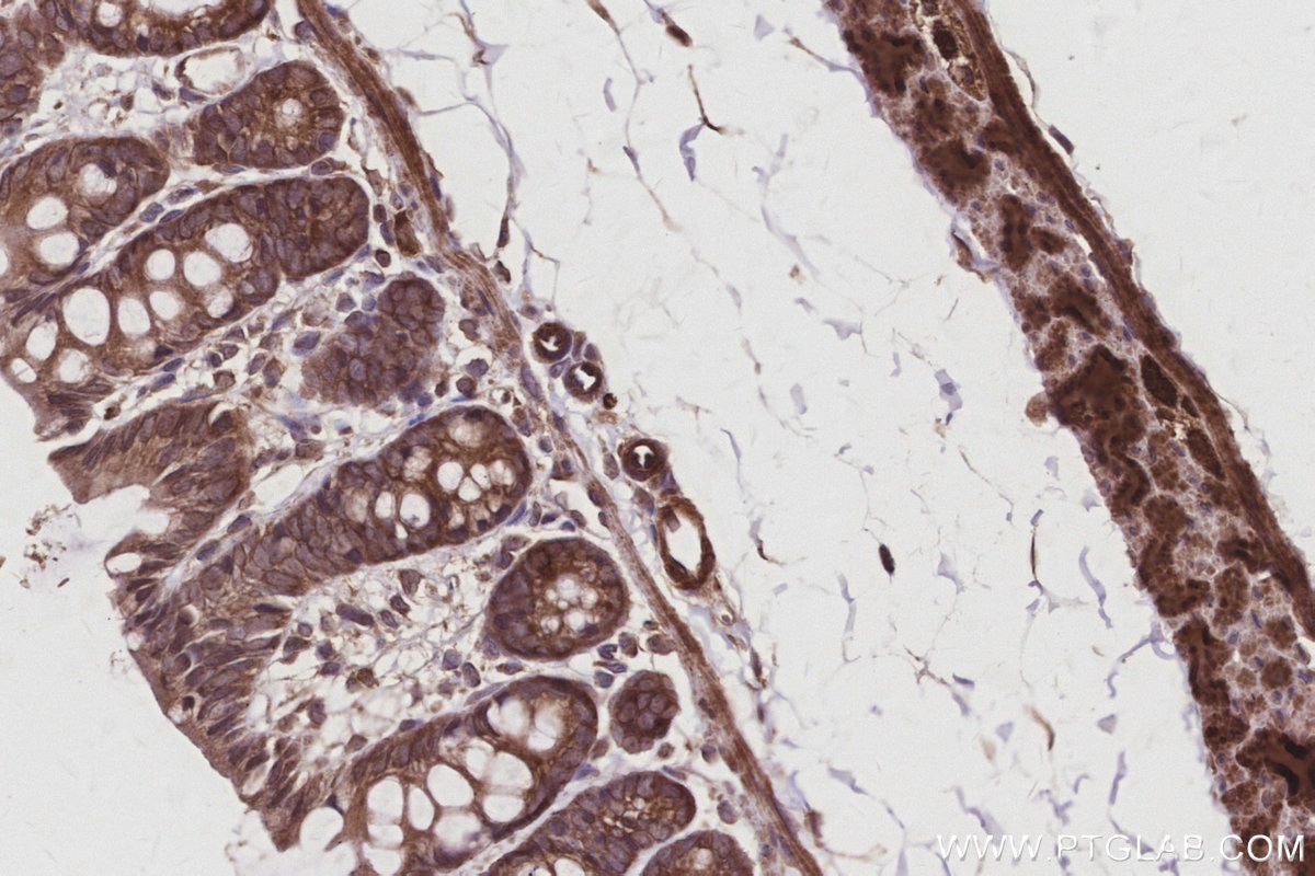 Immunohistochemical analysis of paraffin-embedded rat colon tissue slide using KHC3030 (AMFR/GP78 IHC Kit). Immunohistochemical analysis of paraffin-embedded rat colon tissue slide using KHC3030 (AMFR/GP78 IHC Kit).