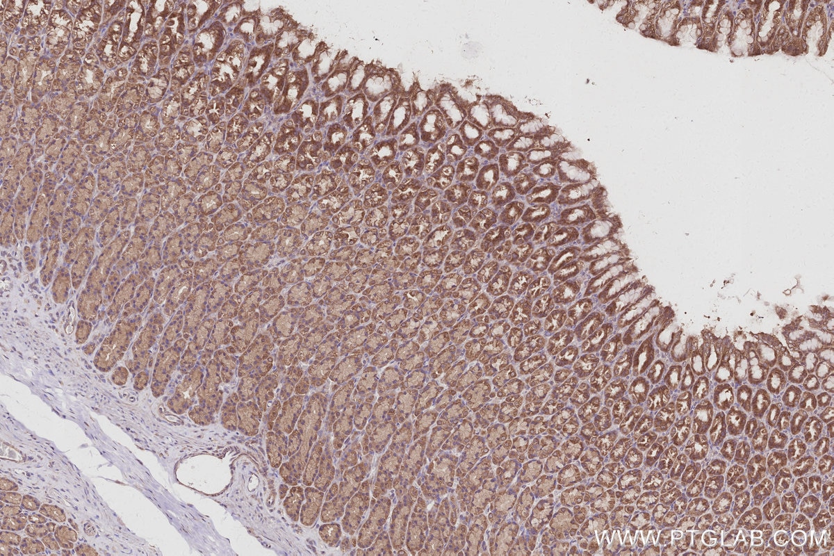 Immunohistochemical analysis of paraffin-embedded rat stomach tissue slide using KHC3030 (AMFR/GP78 IHC Kit). Immunohistochemical analysis of paraffin-embedded rat stomach tissue slide using KHC3030 (AMFR/GP78 IHC Kit).