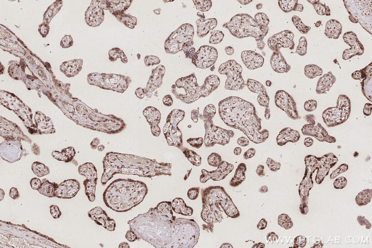 Immunohistochemical analysis of paraffin-embedded human placenta tissue slide using KHC3021 (ANAPC5 IHC Kit).