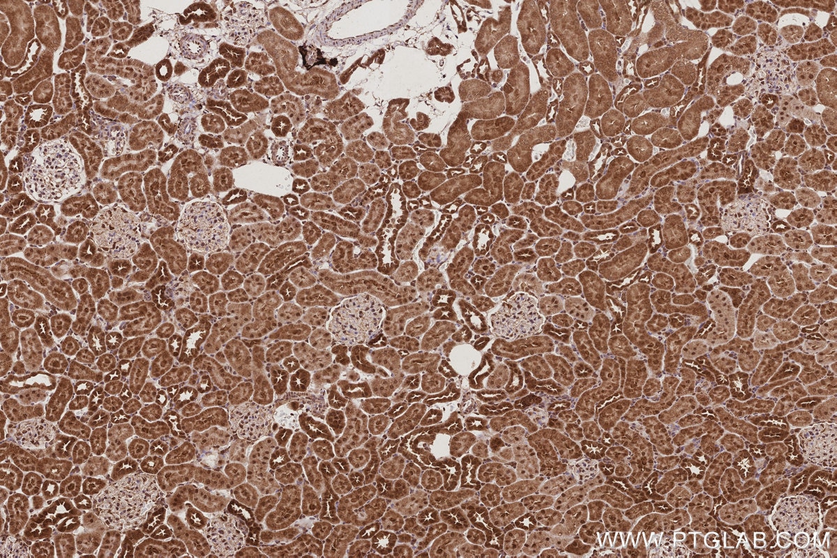 Immunohistochemical analysis of paraffin-embedded rat kidney tissue slide using KHC3021 (ANAPC5 IHC Kit).