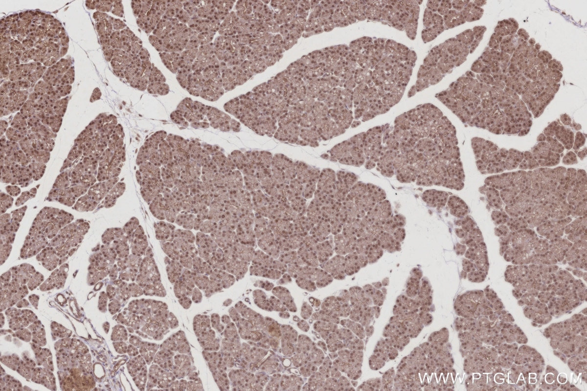 Immunohistochemical analysis of paraffin-embedded rat pancreas tissue slide using KHC3020 (ANAPC7 IHC Kit).