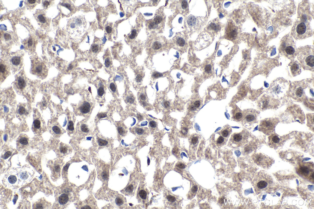 Immunohistochemical analysis of paraffin-embedded mouse liver tissue slide using KHC1505 (ANG IHC Kit).
