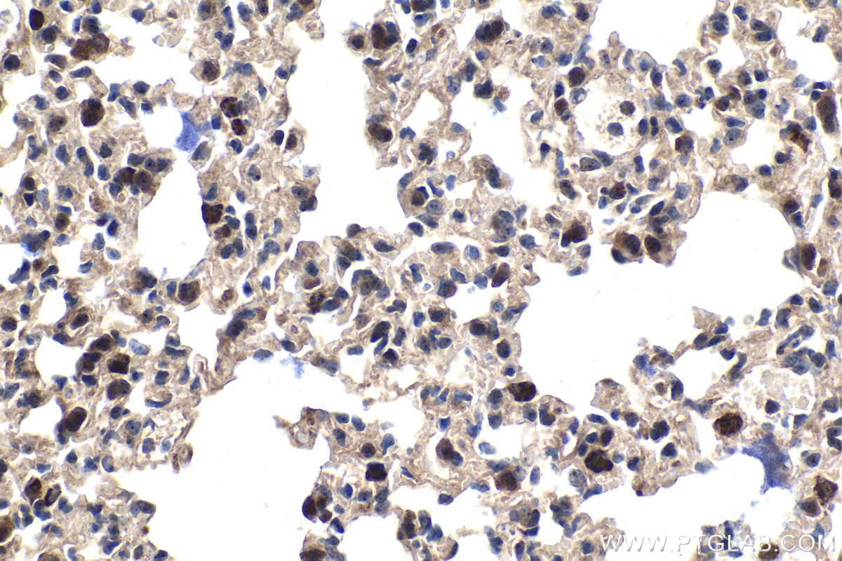 Immunohistochemical analysis of paraffin-embedded mouse lung tissue slide using KHC1505 (ANG IHC Kit).